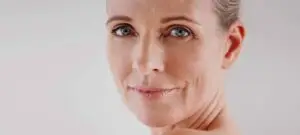 CO2 Laser Skin Resurfacing Wirral